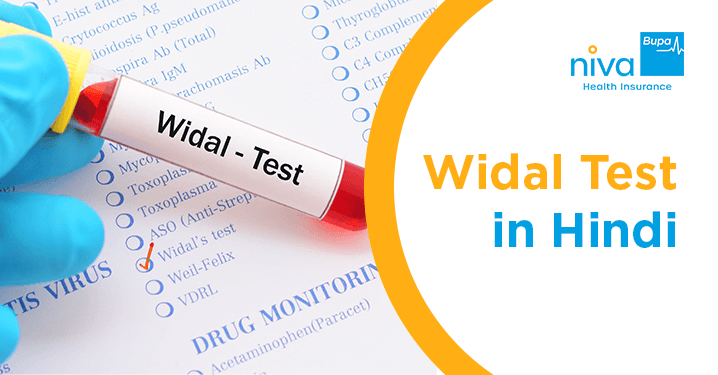 Widal Test