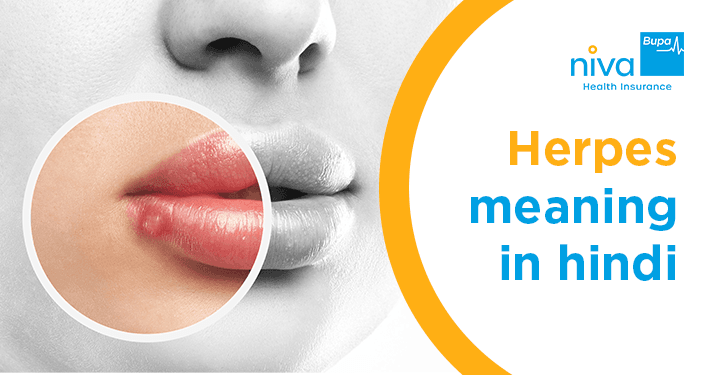 Herpes meaning in hindi
