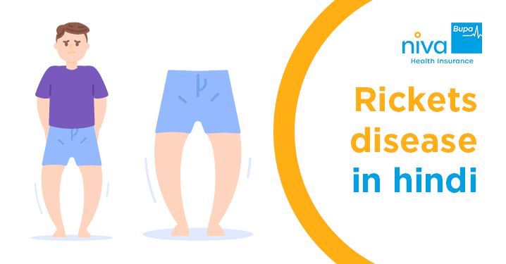 rickets disease