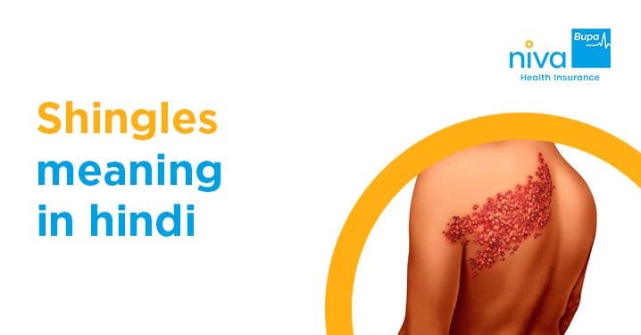Shingles Meaning in Hindi