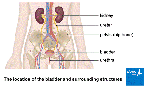 Chronic Kidney Disease_1