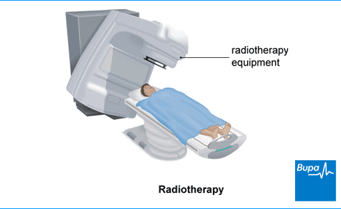 RadioTherapy_1