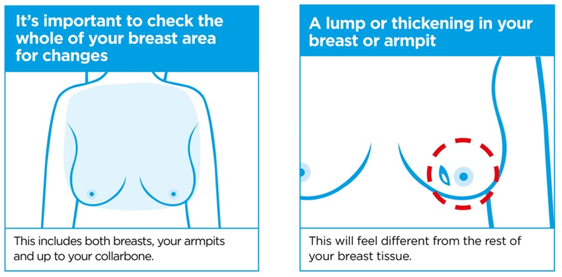 What Determines Breast Size, Breast Shape, and Changes