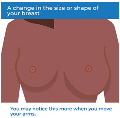 Breast_Cancer_IMG_4