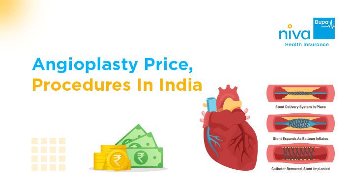 angioplasty surgery price