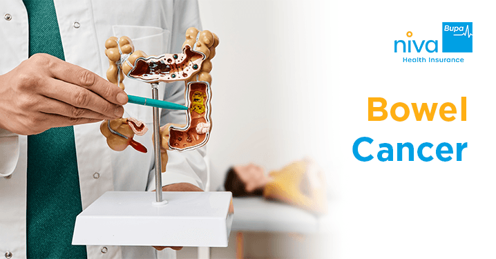 Lifestyle Changes to Prevent Bowel Cancer