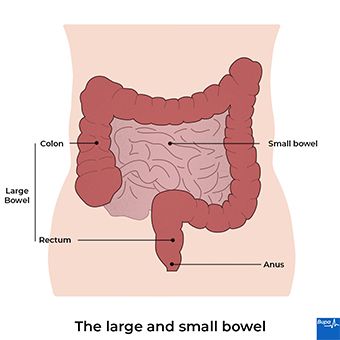 Inflammatory Bowel Disease in Hindi: क्या है और इसके लक्षण