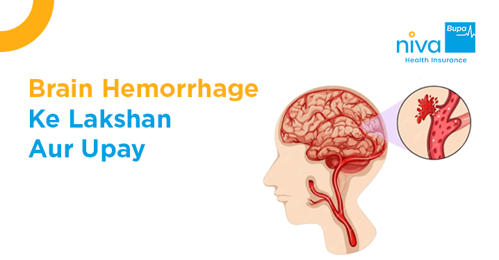 ब्रेन हेमरेज कैसे होता है