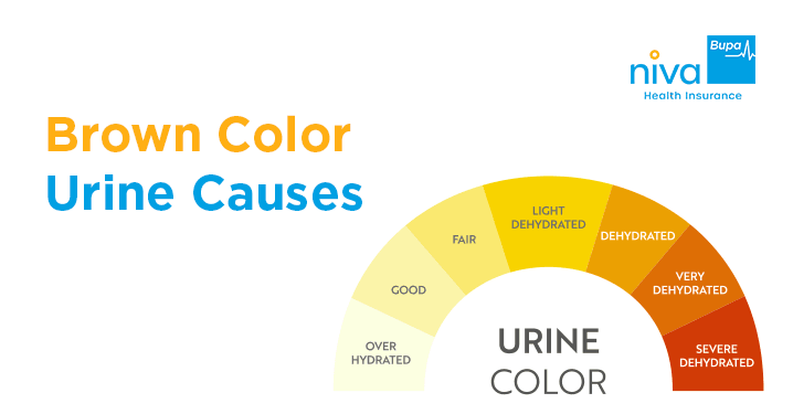 Brown Color Urine Causes