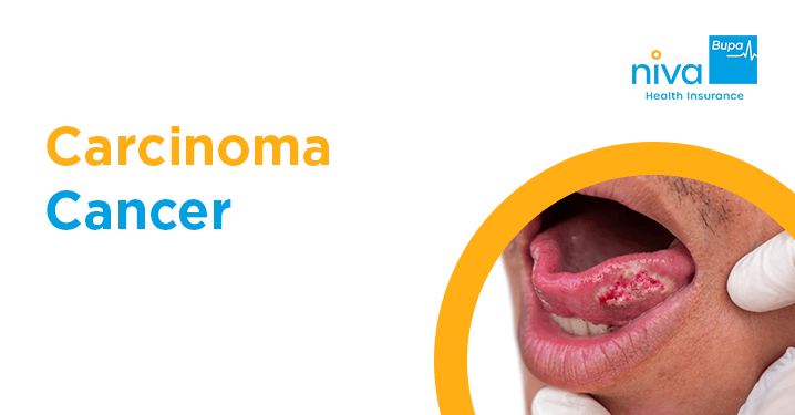 Carcinoma Cancer