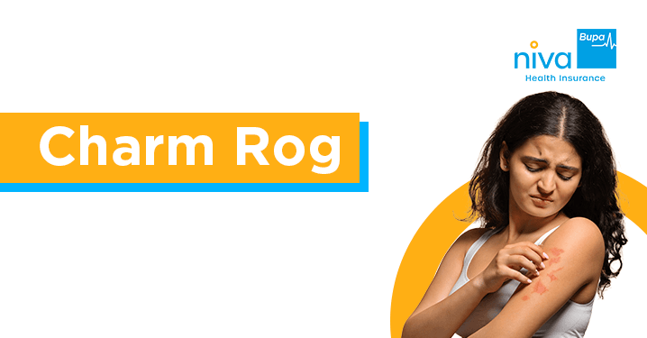 Charm Rog