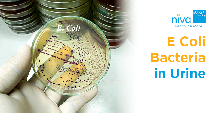 E Coli Bacteria in Urine