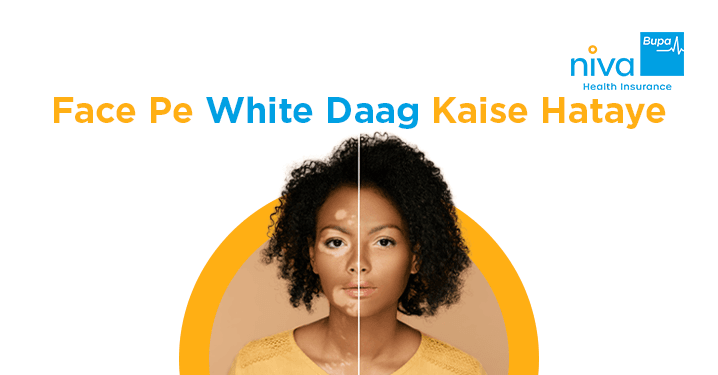 Face Pe White Daag Kaise Hataye