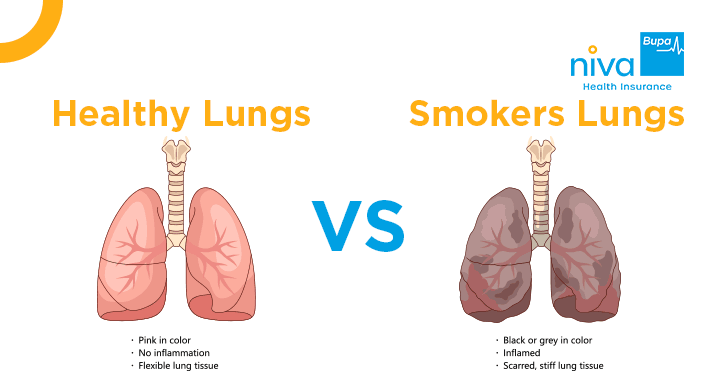 Smokers Lungs vs Healthy Lungs