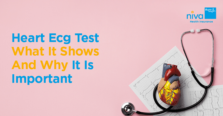 heart ECG test
