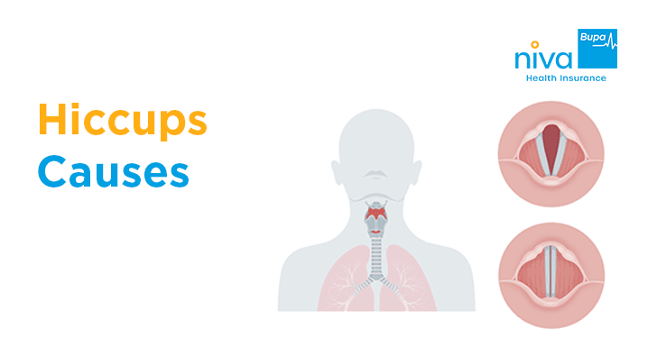 Hiccups Causes
