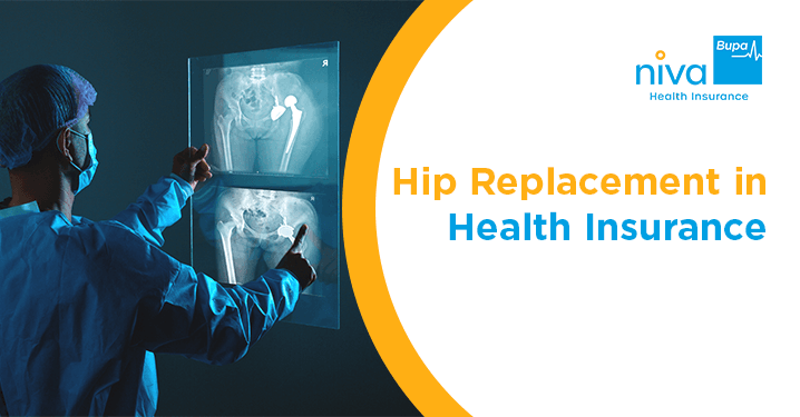 Hip Replacement in Health Insurance