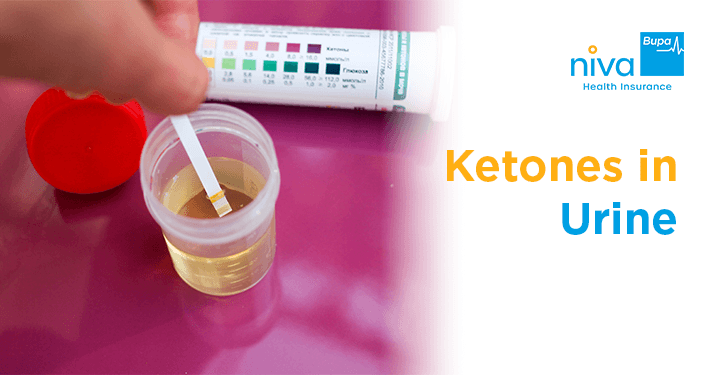 Ketones in Urine