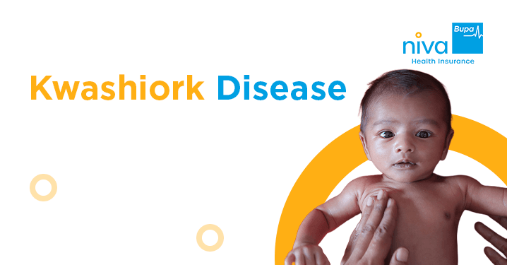 Kwashiorkor Disease: Causes, Symptoms, and Treatment Options