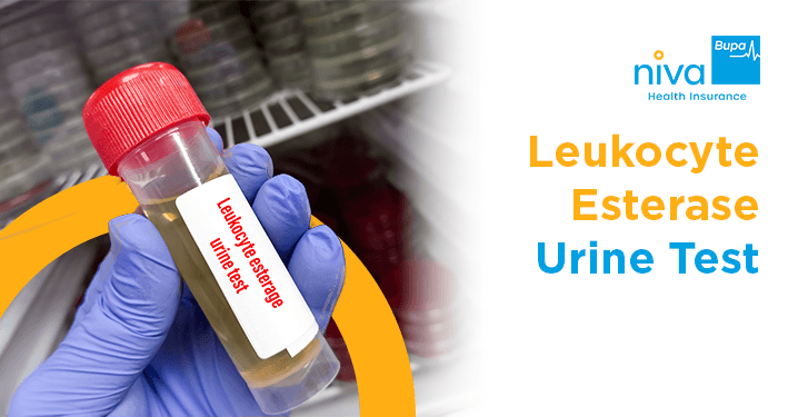 Leukocyte Esterase Urine Test