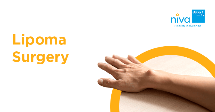 Lipoma Surgery