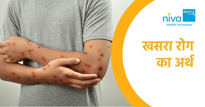 Measles Disease Meaning in Hindi
