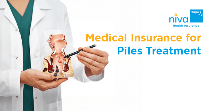 Varicose Vein Treatment in Tamil