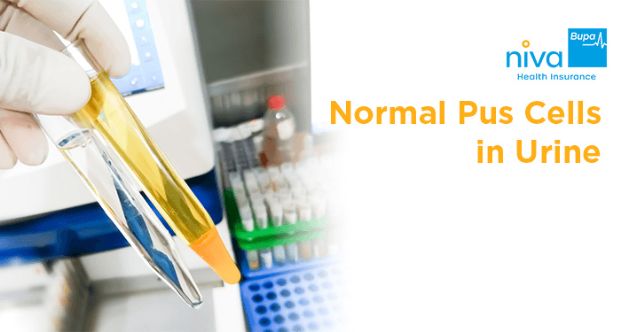 Normal Pus Cells in Urine