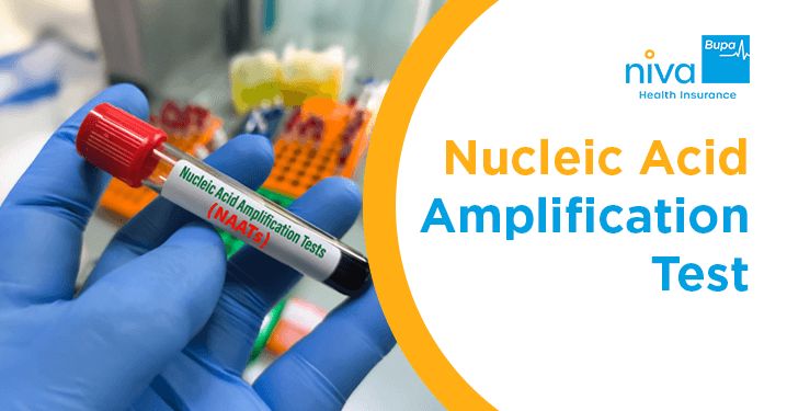 Nucleic Acid Amplification Test