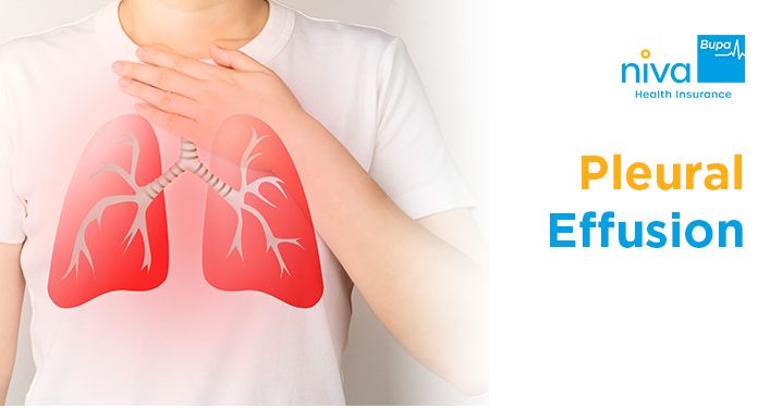 Pleural Effusion In Hindi
