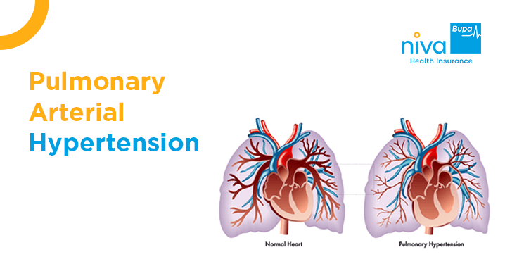 Pulmonary Arterial Hypertension