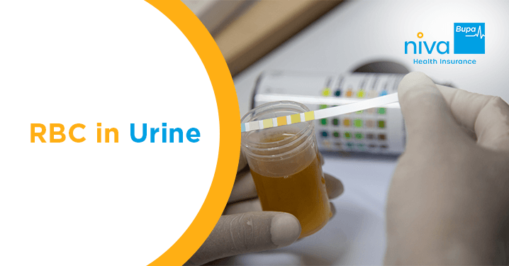 RBC in Urine