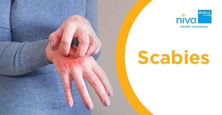 Scabies in Hindi