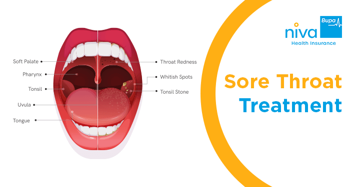 Sore Throat Treatment