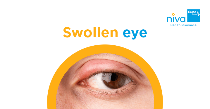 Swollen eye