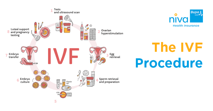 The IVF Procedure