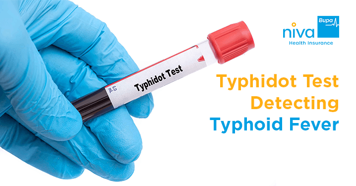Typhidot Test