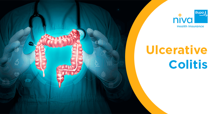 Ulcerative Colitis