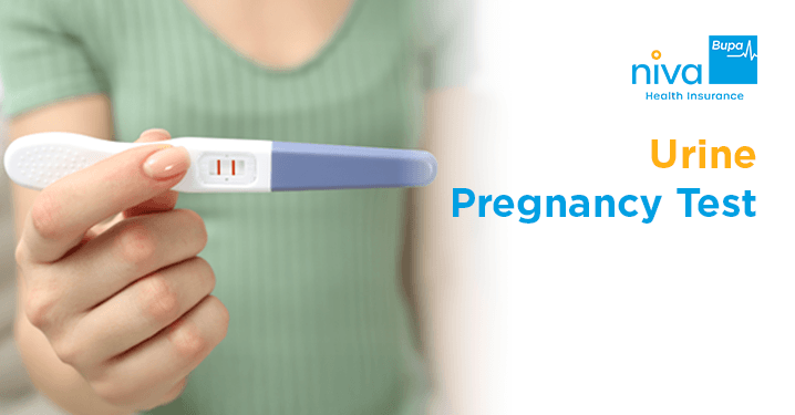 Urine Pregnancy Test