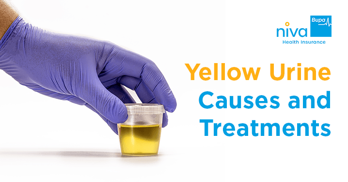 Yellow Urine Causes and Treatments