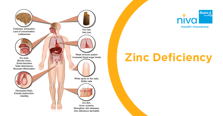 Zinc Deficiency