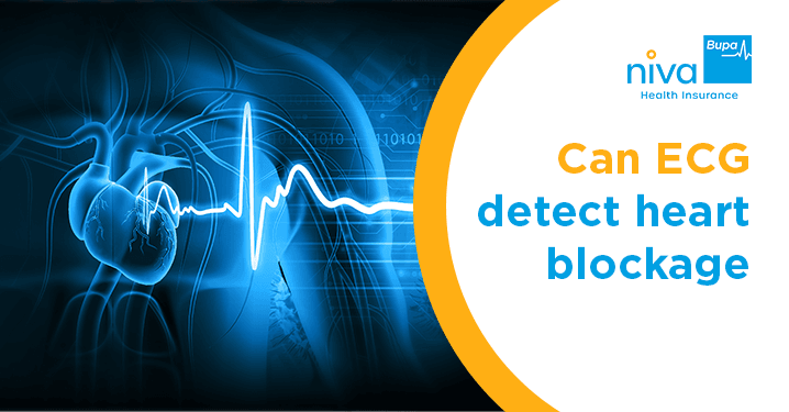 can ecg detect heart blockage