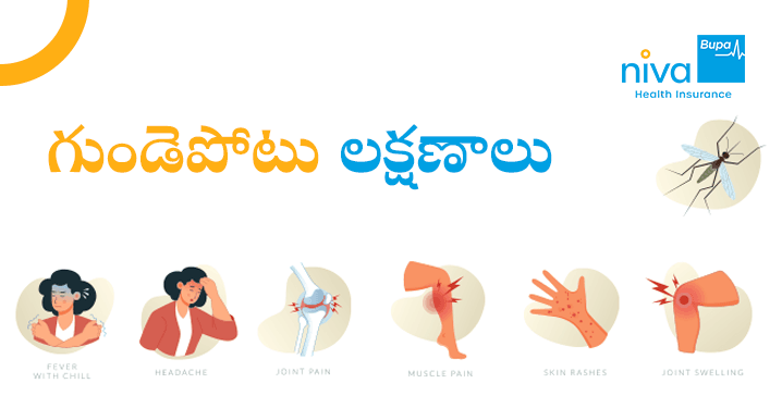 Chikungunya Symptoms in Telugu