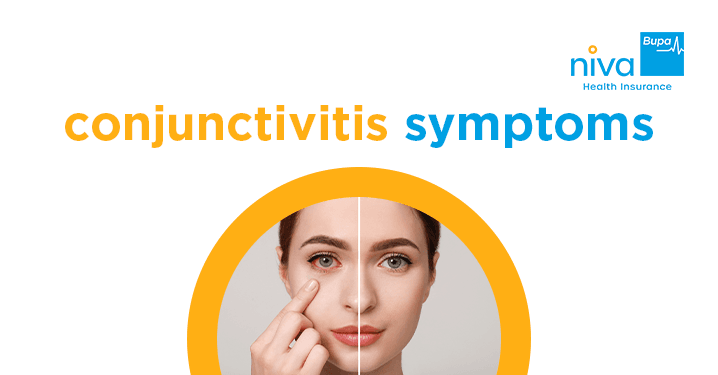 conjunctivitis symptoms