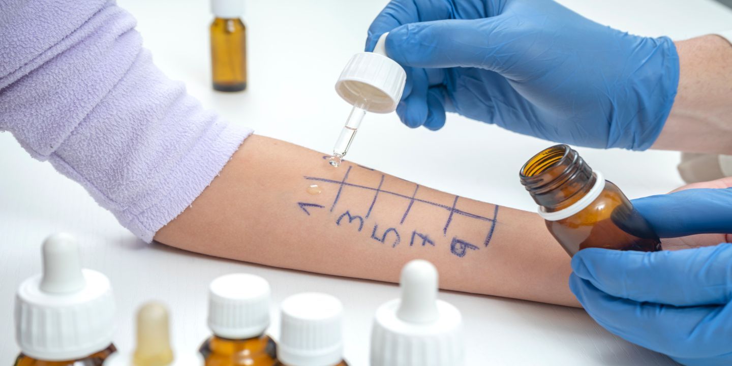 Allergies and Health Insurance