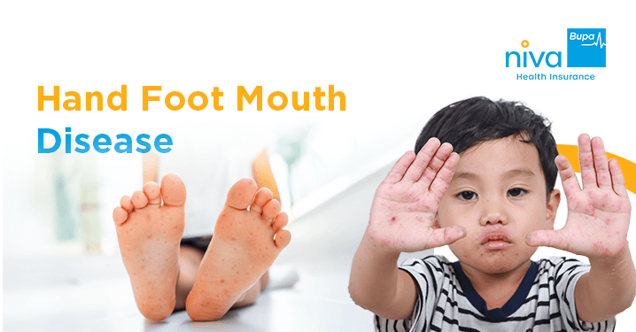 hand foot mouth disease