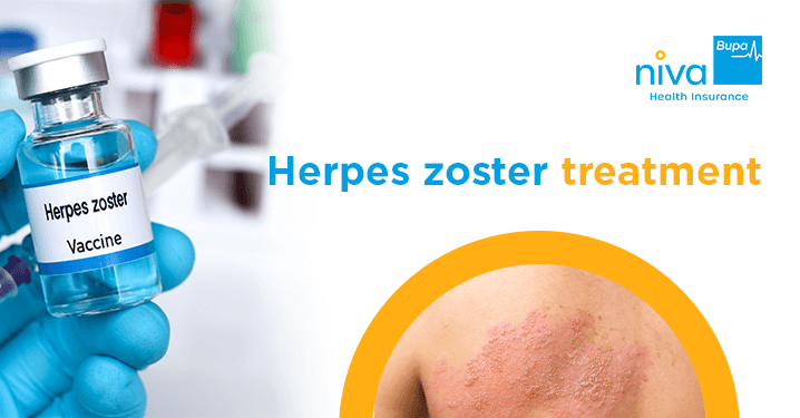 herpes zoster treatment