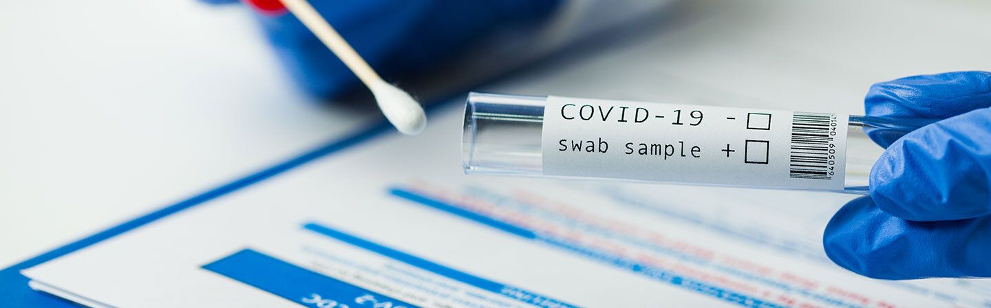 Is Covid-19 Swab Testing Free in India?