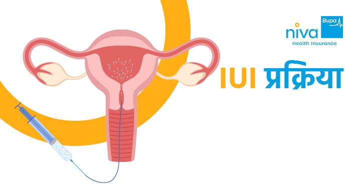 IUI Process in Hindi 