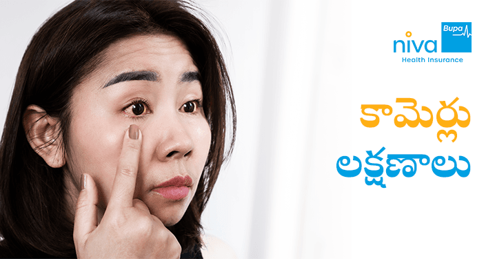 Jaundice Symptoms in Telugu